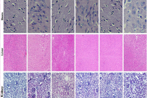 Histology of brain, liver and kidney (H and E x100).