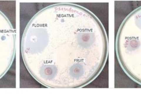 Antibacterial activity of silver nanoparticles.