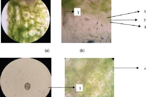 (a) 1. Epidermis, (b) 1. Stomata, 2. Chlorophyll, 3. Cell closing, (c) 1. Ca-Oxalate crystal in rosette, (d) 1. Thickening of the carrier beam spiral shape