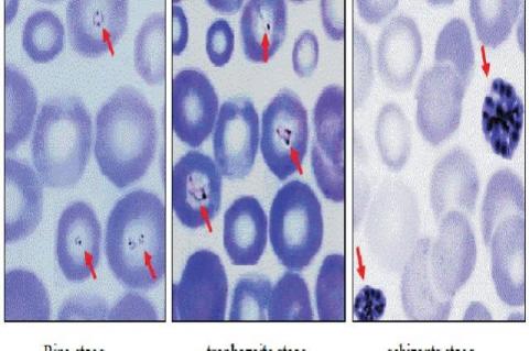 Effect of ethanolic extract of Macaranga gigantea leaves on the life cycle of plasmodium (1000X Magnification)