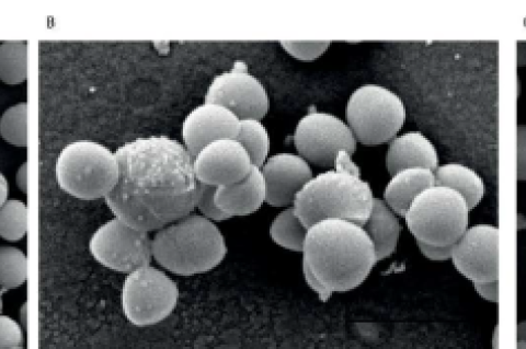 Scanning electron micrographs of untreated MRSA142 (A) and treated MRSA142 with green leaves (B) and golden leaves of Gold leaf Bauhinia (C). Magnification of x 30000.
