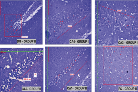 Figure represents the Group 1& 2:AS group- dentate gyrus (150 x 150 sq μm2 area), the Cornu ammonis (300 sq μm length area - CA 1 to CA4) parts of the hippocampus, and Frontal Cortex ( 250 x 250 sq μm2 area FC) respectively