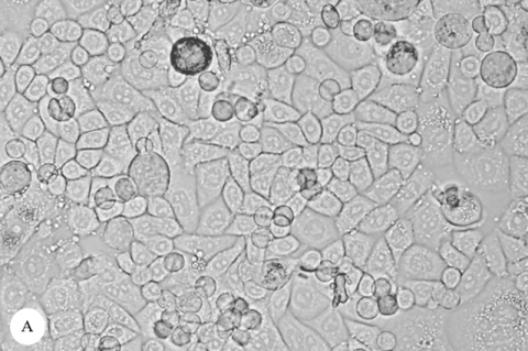 Morphological changes in MCF-7 cells. A: Non-cytotoxic MCF-7 cells (control). B: MCF-7 cells treated with methanolic G. elegans twig extract at 25 μg/mL showing significant cell death and morphological alterations