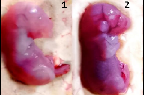 (1) Abnormal Low Birth Weight (LBW) (2) Normal