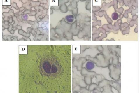 White male mice leukocytes. (A) Segmented neutrophil, (B) Banded neutrophils, (C) Monocyte, (D) Eosinophil, (E) Lymphocyte