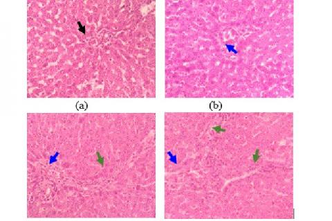 Histopathological examination (HE, 400x) of liver’s male rats in a subchronic oral toxicity stud