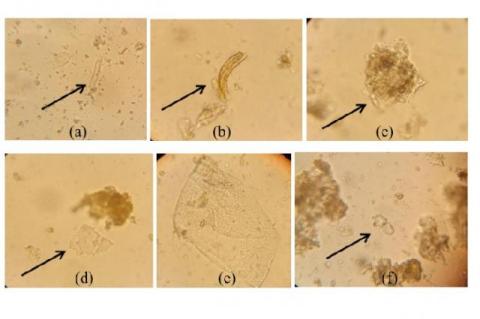 (a) Hair covering, (b) ladder-shaped transport, (c) parenchyma with secretion cells, (d) oxalate crystals, (e)parenchyma tissue and (f) stomata