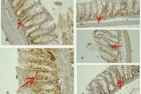 Figure 1: TNF-α expression in colonic organ of mice with immunohistochemical staining in each treatment group. Magnification: ×400. (a) Normal group, (b) Negative control group, (c) Aspirin group, (d) High dose of pomegranate peel ethanol extract (e) Low dose of pomegranate peel ethanol extract. The red arrows indicate TNF-α expression in the form of brown-stained cells in the crypt’s cytoplasm.