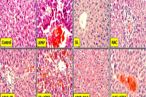 A representative image for liver histology of studied groups. Liver slices stained with H&E, X400.