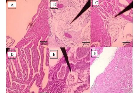 Cardiac morphology of mice. A. control, B. Obese0, C. Obese2, D. Obes7, E. Obese14, F. Obese21.