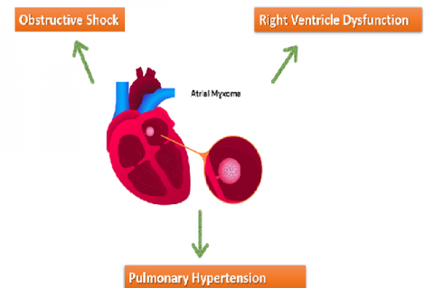 Graphical Abstract 