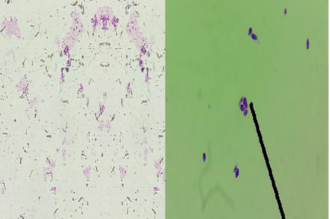 From left to right, the Leishmania promastigotes are observed, followed by the figure on the right belonging to the Leishmania axenic amastigotes.