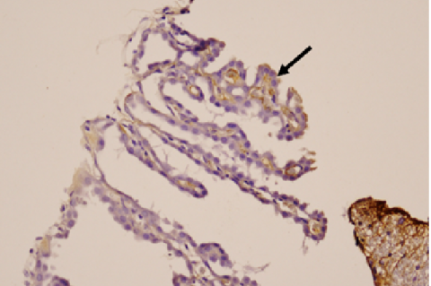 The IHC staining on cross-sections of rats in the hydrocephalus group on day 21 was viewed under a microscope with 100x magnification.