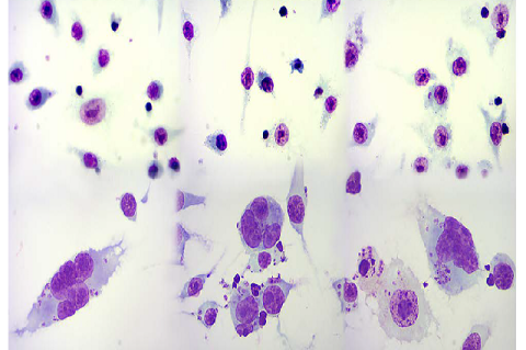 On top, RAW264.7 macrophages infected with Leishmania (V.) braziliensis at 24 hours showing mononuclear cells in 3 fields (100X).