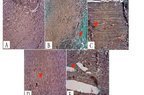 Mason's trichrome staining analyses for GSH in all groups