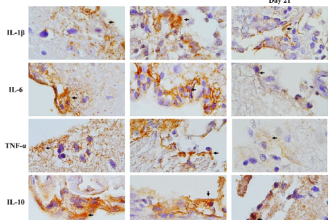 The representative images of IL-1β, IL-6, TNF-α, and IL-10 cytokines expression in subventricular zone.