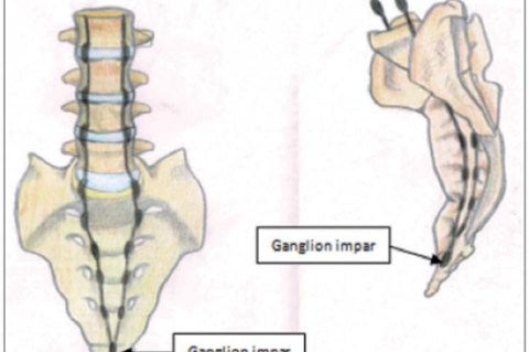 Ganglion impar anatomy