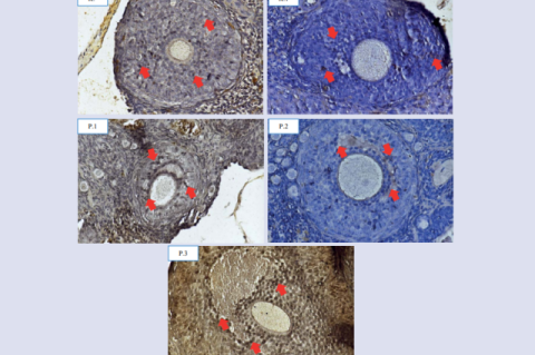 BMP-15 expression in each group. The red arrow shows the expression of BMP-15 in the granulosa cells of the follicles which is indicated by  the presence of brown chromogen (IHC 400x)