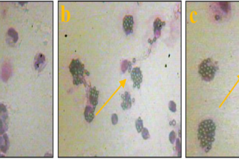 Macrophages that phagocytozing latex of (a) water fraction, (b) chloroform fraction and (c) hexane fraction.