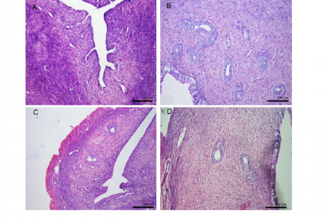 Representative photomicrographs of uterine histology. A = Ovariectomized rats;