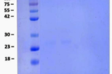 SDS-PAGE results of snakehead fish extract peptides