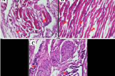 Histopathological appearance of tortoise skeletal muscles with suspected MBD 